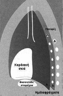 Εικόνα 5. Σχηματική αναπαράσταση ανατομικών δομών σε αριστερή πλάγια ακτινογραφία θώρακα. κασέτα του φίλμ στη ραχιαία επιφάνεια του θώρακα, επικεντρώνοντας στη λαβή του στέρνου (Εικόνα 6).