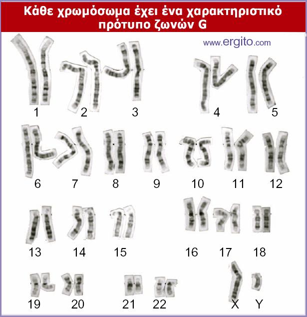 ΗζώνωσηG δημιουργεί μια χαρακτηριστική