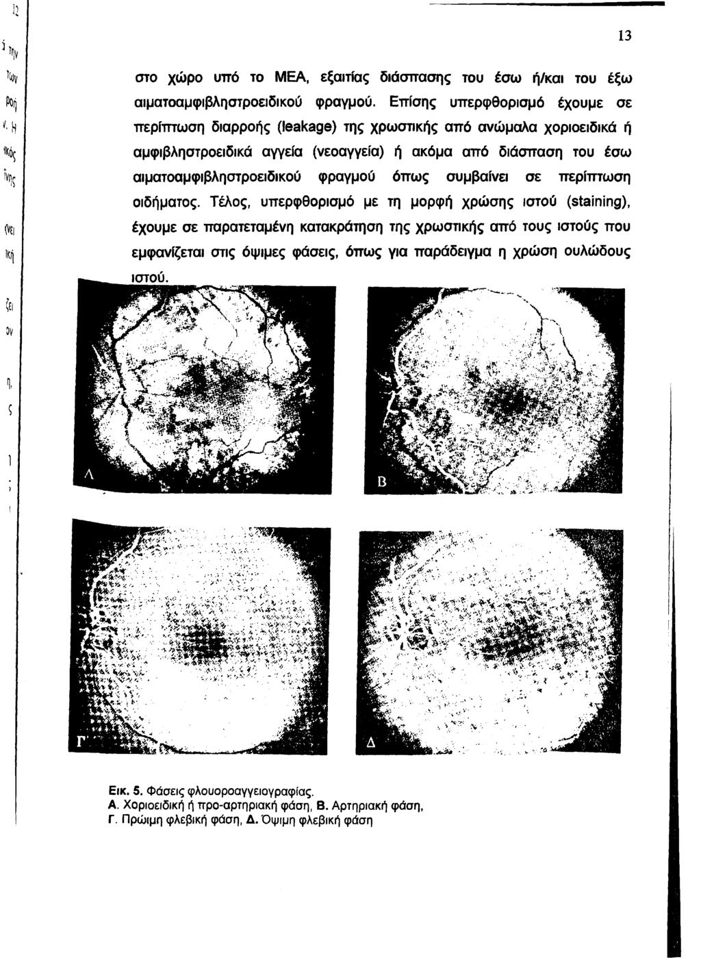 13 στο χώρο υπό το ΜΕΑ, εξαιτίας διάσπασης του έσω ή/και του έξω αιματοαμφιβληστροειδικού φραγμού.