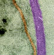 Peptidoglicano Periplasma