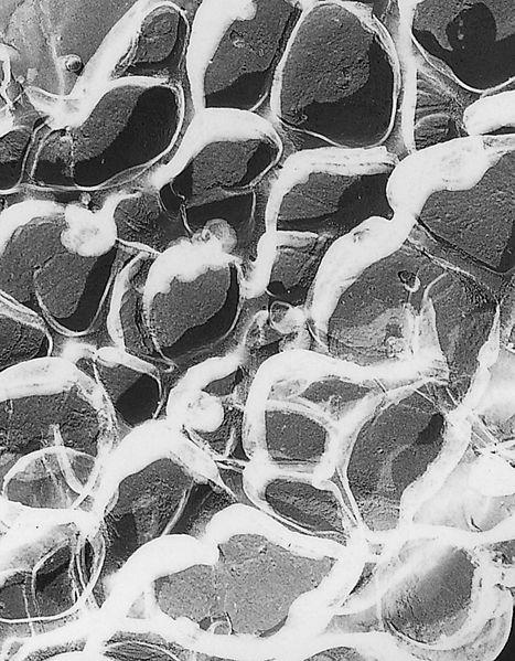 Μέγεθος πόρων και μετακίνηση πρωτεϊνών Transmission- Electron Microscopic image of a polyacrylamide gel.
