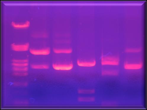 Ανάλυση κατά Southern: σχηματική πορεία DNA DNA μετά από