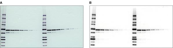 Ανοσοαποτύπωμα Colorimetric and chemiluminescent blots.