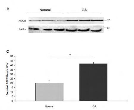 Ειδικό Μέρος Αποτελέσματα p<0.0001 Εικόνα 30. A. Επίπεδα έκφρασης του mrna του FGF-23 ομαλοποιημένα ως προς την έκφραση του γονιδίου αναφοράς GAPDH σε ΟΑ και φυσιολογικά χονδροκυττάρα Β.