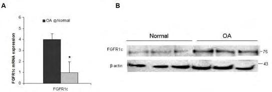 Ειδικό Μέρος Αποτελέσματα μεταξύ οστεοαρθριτικών και φυσιολογικών χονδροκύτταρων η μελέτη συνεχίστηκε με τη διερεύνηση της δημιουργίας συμπλόκου μεταξύ FGF23 και FGFR1c στα οστεοαρθριτικά και