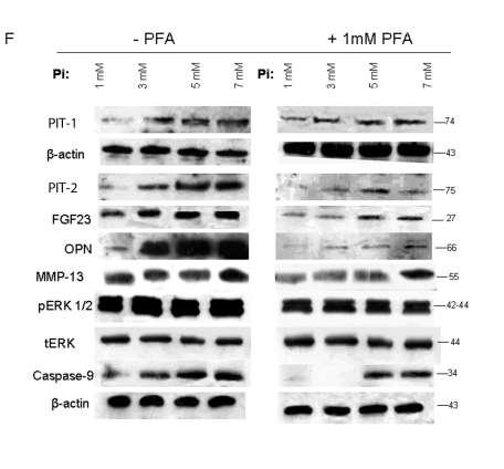 Ειδικό Μέρος Αποτελέσματα p<0,0001 Εικόνα 36. Επίδραση με 3, 5, 7mM Pi μαζί ή χωρίς 1mM PFA σε καλλιέργειες φυσιολογικών χονδροκυττάρων. Μεταγραφικά επίπεδα έκφρασης των A. PiT-1, B. PiT-2, C.