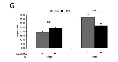 Πρωτεϊνική έκφραση των PiT-1, PiT-2, FGF23, OPN, MMP-13 και κασπάσης-9 ομαλοποιημένη ως προς την πρωτεΐνη αναφοράς β-actin και πρωτεϊνικά επίπεδα της perk ομαλοποιημένα ως προς τα επίπεδα της terk1/2.