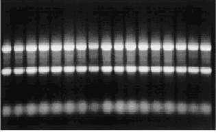 Ειδικό Μέρος Υλικό και Μέθοδοι Για να ελεγχθεί η ποσότητα του RNA πραγματοποιήθηκε φωτομέτρηση σε κάθε δείγμα. Αραιώσεις κάθε δείγματος (1:100) φωτομετρήθηκαν στα 260 και 280 nm.