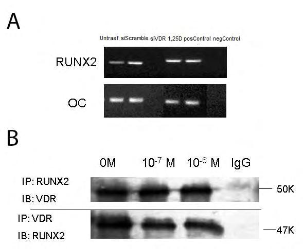 Ειδικό Μέρος Αποτελέσματα ιστογράμματα αντιπροσωπεύουν την αύξηση ή μείωση της μεταγραφικής έκφρασης του RUNX2 στα ΟΑ χονδροκύτταρα συγκριτικά με τα φυσιολογικά. Β.2.6.