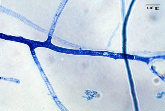 Μυκητυλλιακοί ή αληθείς µύκητες ΓΕΝΙΚΗ ΜΥΚΗΤΟΛΟΓΙΑ Το µυκητύλλιο διακρίνεται σε βλαστικό και αναπαραγωγικό Το βλαστικό µυκητύλλιο