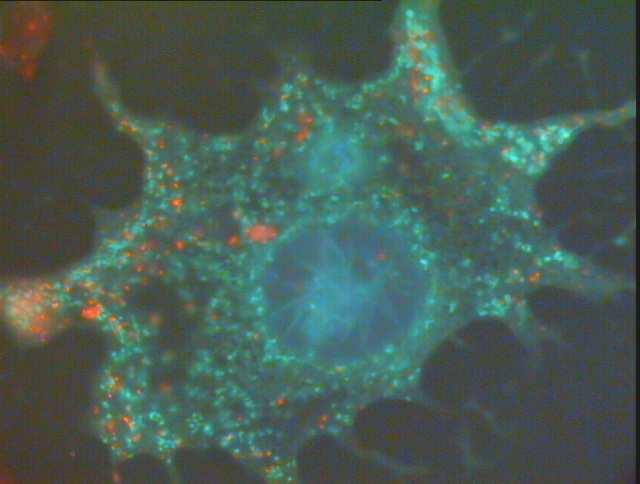 Lizosomu izmēri parasti ir no 0,2-0,5 µm. Lizosomu galvenā funkcija ir veikt iekššūnas sagremošanu. Lizosomas žurku nieru šūnās. Kāmju olšūnas.