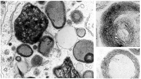 Tā rezultātā veidojas otrējā lizosoma vai autofāgiskā vakuola, kurā bojātās struktūras tiek sadalītas Autofāgiskā vakuola ar mitohondrijiem.