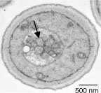Vakuolas augu šūna Vakuolas raugu šūnās Vakuolu subpopulācijas Arabidobsis thaliana epidermas šūnās. Atškiras to ph un, iespējams, funkcijas. http://www.brookes.ac.
