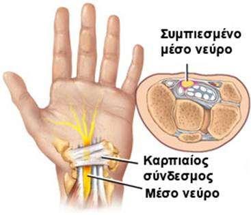 Εικόνα 21 η
