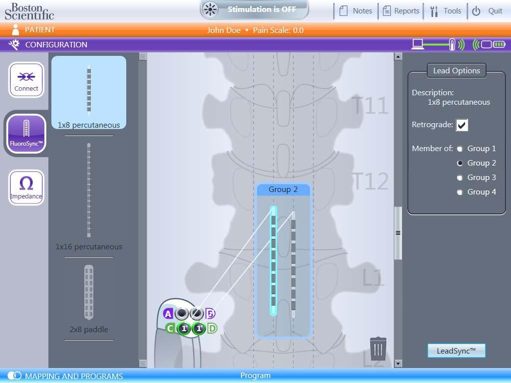 Εγχειρίδιο προγραμματισμού Bionic Navigator 3D Αλλαγή του προσανατολισμού απαγωγής στον πίνακα τοποθέτησης απαγωγών Από την οθόνη Leads (Απαγωγές): 1. Επιλέξτε απαγωγή. 2.