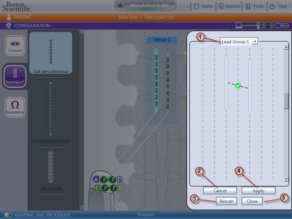 Εγχειρίδιο προγραμματισμού Bionic Navigator 3D Χρήση τεχνολογίας LeadSync Η τεχνολογία LeadSync σάς επιτρέπει να μετρήσετε τον σχετικό ραμφο-ουριαίο προσανατολισμό μεταξύ δύο ή περισσότερων απαγωγών