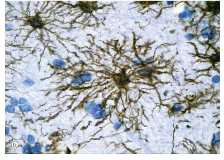3) Glijafilamenti od glija fibrilarnog kiselog proteina (GFAP) U glijalnim ćelijama nervnog