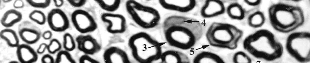 A) 2, 3, 4 B) 3, 5, 6 C) 1, 5, 7 D) 1, 4, 2 E) 2, 6, 7 69. Rianodin reseptorlu-ca 2+ kanalları nəyin təsirindən açılırlar?