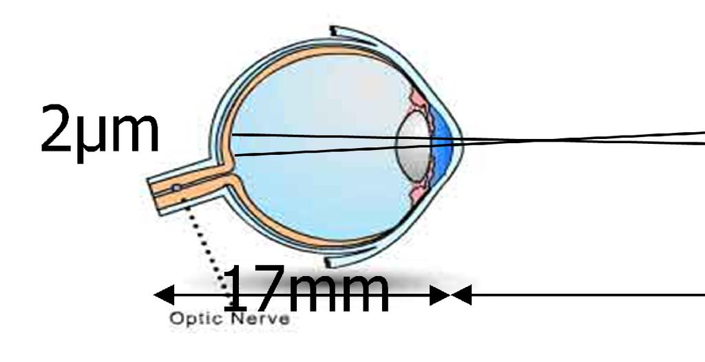 pacientul semnul cel mai mic si 2) distanta de la care acest semn este vazut sub un unghi de 5 minute de arc de cerc.