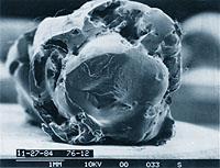 implantului Locul unde s-a realizat implantarea Compusii absorbiti pe polimer Factori fizici: