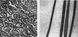4 Aspect microscopic Observaţii Bumbac Secţiunea transversală este aproximativ circulară; are un aspect aplatizat, curbat spre extremităţi, uneori în formă de bob de fasole