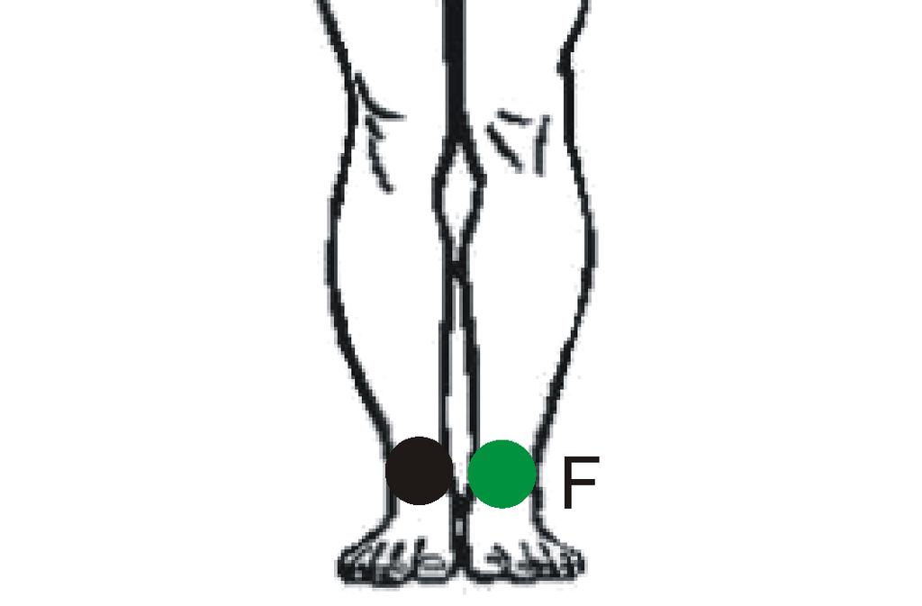 Figura 5. Poziția electrozilor de la nivelul membrelor.