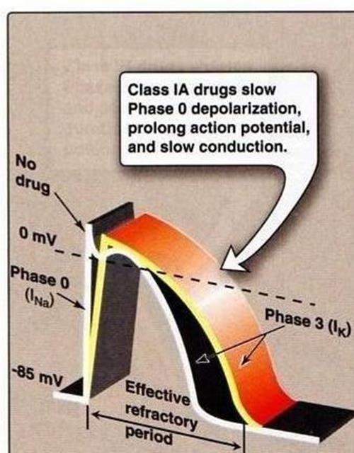 Grupa IA Umerena depresija automatizma i provodljivosti, produžavanje repolarizacije i refraktarnog perioda Blokatori M Rc-a Hinidin, prokainamid, dizopiramid