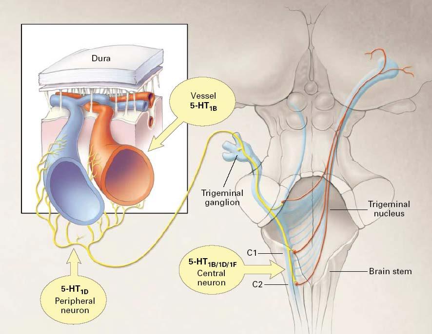 Serotonin i 5HT agonisti inhibiraju atak migrene 5HT 1B vazokonstrikcija kondukcioni sudovi Friberg i sar. 1991., Sperling 1995. cerebralna cirkulacija Connor i sar.