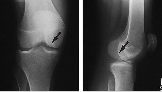 Risk of injury Elite level High Intensive training programs High-frequency participation in