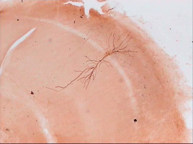 69 350 µm Εικόνα 29: Φωτογραφία νευρώνα του ραχιαίου ιπποκάµπου.