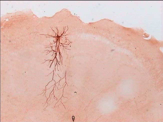 70 350 µm Εικόνα 31: Φωτογραφία νευρώνα του κοιλιακού