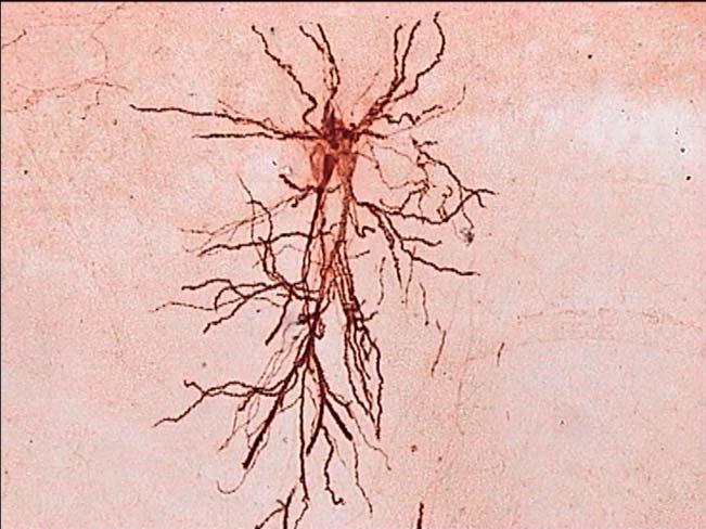 140 µ Εικόνα 32: Ο παραπάνω νευρώνας σε µεγαλύτερη µεγέθυνση