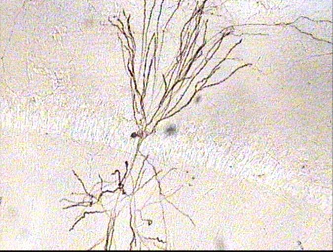 71 0 µm Εικόνα 33: Φωτογραφία νευρώνα του ραχιαίου ιπποκάµπου (10Χ).
