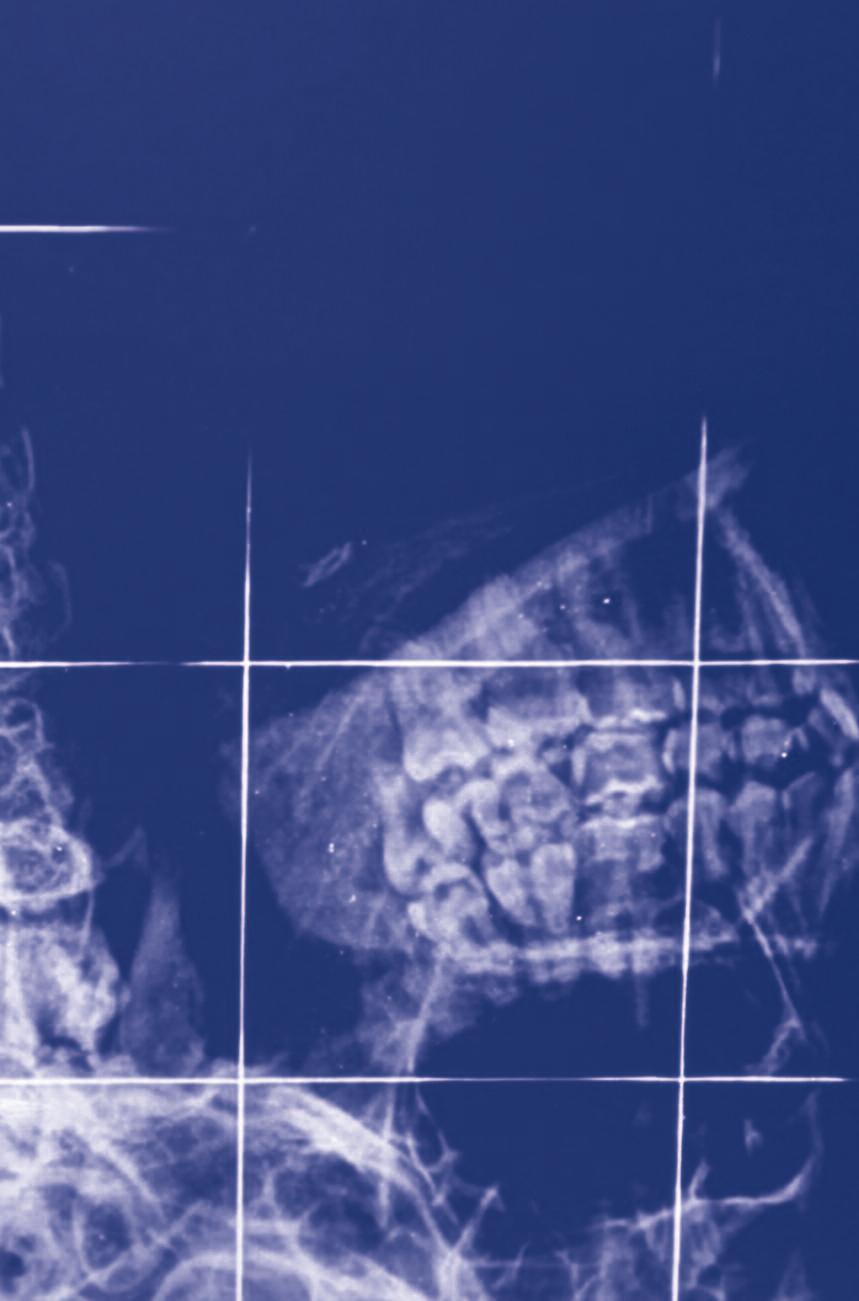 OSTEONECROSIS OF THE JAW http://ecancer.org/education/module/276-osteonecrosis-of-the-jaw.