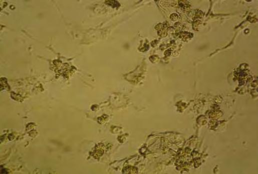 Εικόνα 6: Καλλιέργειες των κοκκωδών κυττάρων μετά από επώαση 24 ωρών με τον ανταγωνιστή 11.