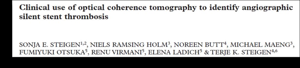 ACS 15 months after LAD PCI: