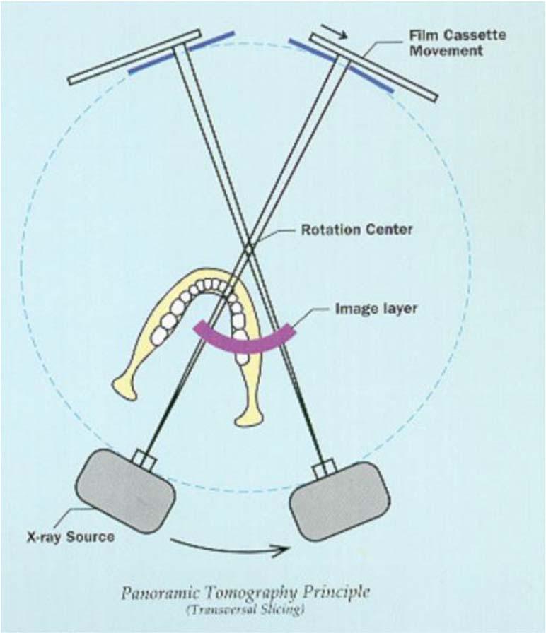 Πανοραμική ακτινογραφία Η πηγή κινείται πίσω από την κεφαλή του ασθενούς Η θήκη της πλάκας και το μεταλλικό διάφραγμα κινούνται μπροστά από