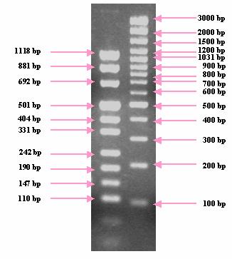 Μετά την PCR ακολουθεί ηλεκτροφόρηση των προϊόντων σε πηκτή αγαρόζης. Η συγκέντρωση του βρωμιούχου αιθιδίου είναι 5 mg/ml.