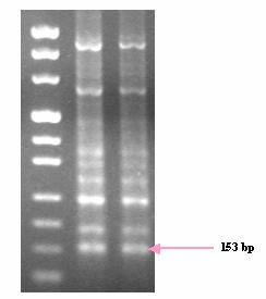 Πρόκειται για τις γονιδιωματικές περιοχές που ενισχύθηκαν με PCR από τα ζεύγη των εκκινητών hndb_f-hndb_r και hnf_f1-hnf_r1.