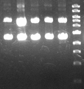 Εικόνα 61 Ηλεκτροφόρηση του απομονωμένου πλασμιδιακού DNA 5 θετικών κλώνων της κλωνοποίησης. Ο μάρτυρας που χρησιμοποιήθηκε είναι ο NEB 1 kb Ladder.