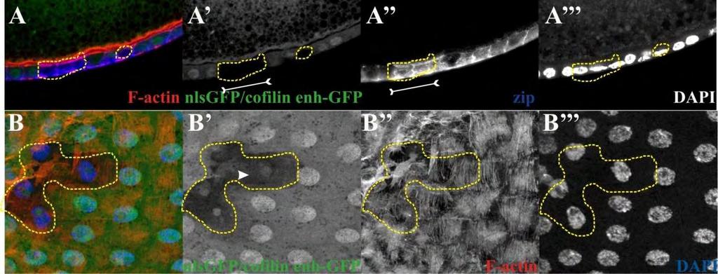 βμκζδίςκ ηςκ profiln ηαζ cofilin, ηαζ υπζ ζηδ ζοκμθζηή έηθναζδ ηςκ βμκζδίςκ ηςκ profilin ηαζ cofilin.