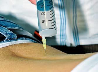Sfaturi fitoterapeutice Rolul şi locul ozonoterapiei în tratamentul complex al diabetului zaharat zonoterapia este o metodă alternativă şi inovatoare de tratament nemedicamentos care foloseşte un