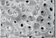 Ηλεκτρονικό μικροσκόπιο σάρωσης που δείχνει την πλήρη αφαίρεση των βακτηρίων και του πολφικού ιστού στο ακρορριζικό τριτημόριο μετά από διακλυσμούς με laser αποτελεί ακόμη το κατάλληλο υγρό
