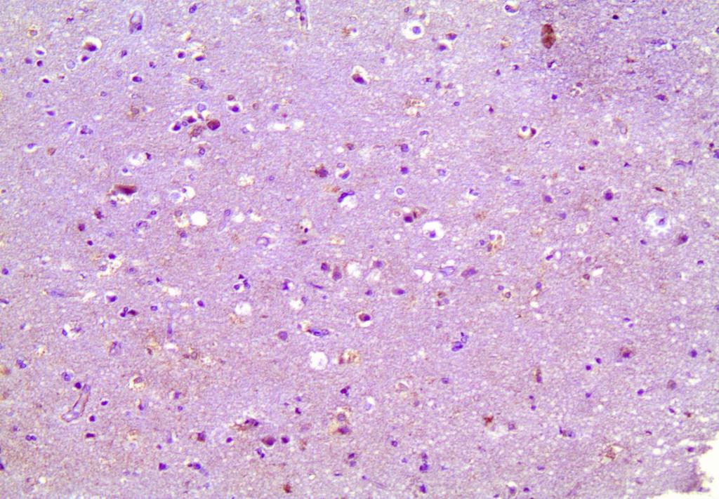 Εικόνα 14 Β: Αρνητικά για την ALDH5A1 γλοιακά κύτταρα σε φυσιολογικό εγκεφαλικό ιστό. 3.