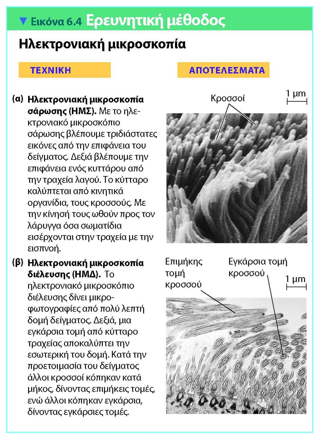 CAMPBELL REECE, ΒΙΟΛΟΓΙΑ ΤΟΜΟΣ Ι, ΠΕΚ 2010 Στο ΗΜΣ, η επιφάνεια του δείγματος καλύπτεται με ένα φιλμ χρυσού το οποίο σαρώνεται από μία δέσμη ηλεκτρονίων που διεγείρει τα ηλεκτρόνια της επιφάνειας του