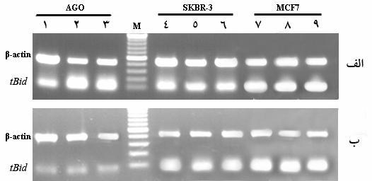 ساميلا فرخيمنش و همكاران طراحي يك پروموتر كايمريك در سلولهاي سرطاني سينه ۷۸-۳ - ۳ نتايج RT PCR نيمهكمي پس از انتقال سازه به سلولهاي يوكاريوتي و اعمال تيمارهاي متفاوت جداسازي RNA و سنتز cdna تكثير