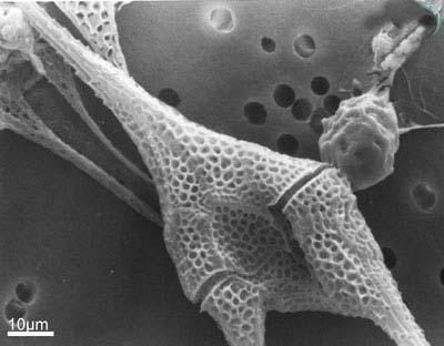 Ceratium