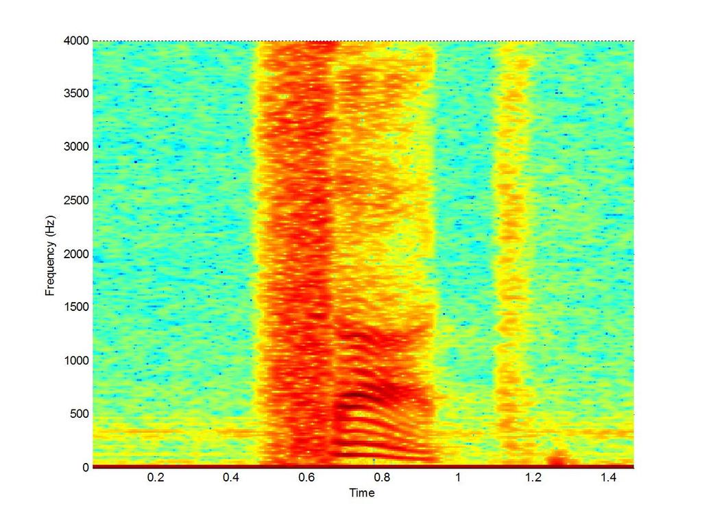 Slika 24: Spektrogram govornog