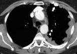 Thorax 2015;70:192-3 Tsim S et al.