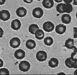 Filtrirane slike: (c) pravougaonim uniformnim filtrom (5x5), (d) piramidalnim